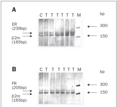 Figure 1. Analysis of the estrogen receptor (ER) (A) and progesterone  receptor (PR) (B) messenger ribonucleic acid (mRNA) expression in the  endometrium, myometrium and vagina of women treated with estriol,  taking the ß2-microglobulin (ß2-m) levels as th
