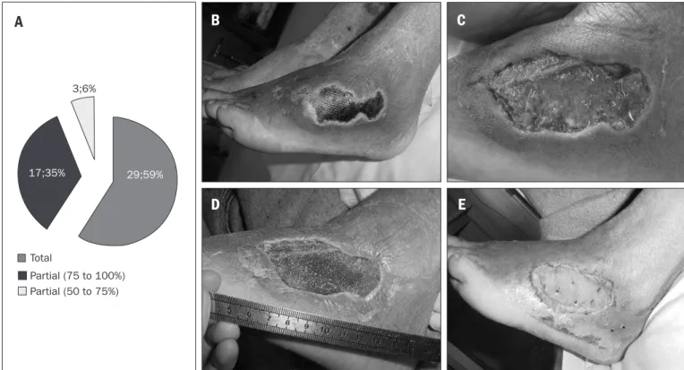 Figure 2. Results from skin grafts. A – Results from patients undergoing skin graft surgery