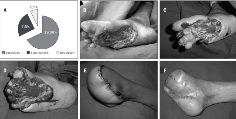 Figure 3. Results from treatment with laps. A - Distribution of patients undergoing skin lap surgery