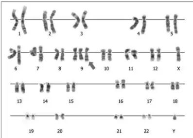 Figure 2. Cytogenetic analysis of the patient #1.