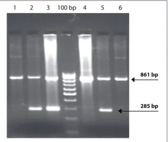 Figure 1. PCR result from six symptomatic patients, in which lanes  2, 3 and 5 are positive for IVS 1-5 mutation (bp = base pairs).