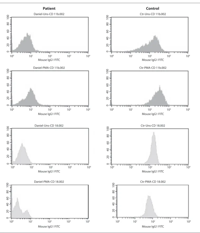 Figure 1. Flow cytometry analysis. Detection of CD18 expression in peripheral blood neutrophils and lymphocytes, in the LAD-1 patient  and a healthy control