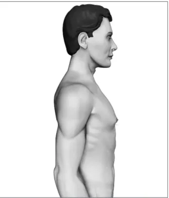 Figure 2. Grade I – Increased diameter and slight protrusion  limited to the areolar region.