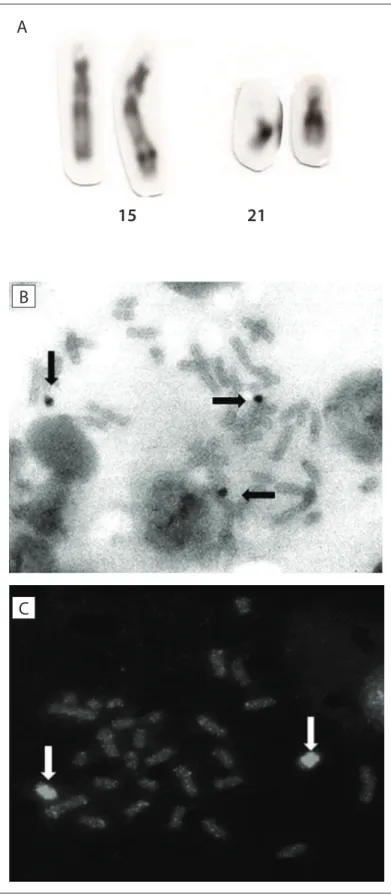 Figure 2. Cytogenetic analysis. (A) GTG-banded partial metaphase. 