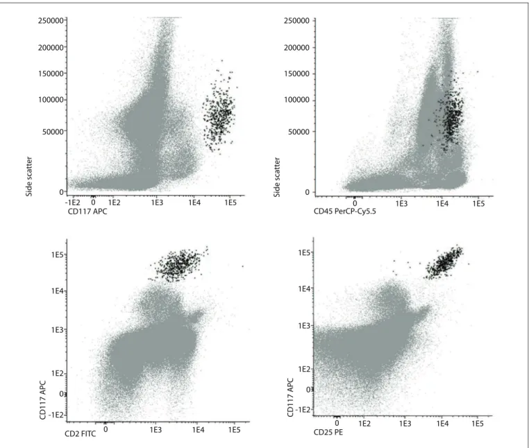 Figure 4. Representative bivariate dot plots illustrating mast cells (black) identiied by means of low cytometry based on CD117 and  CD45 expression, with anomalous expression of CD2 and CD25, in a case of systemic mastocytosis.