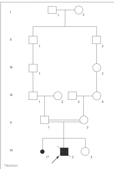 Figure 1. Pedigree of the family showing the consanguinity observed  between the patient’s parents.