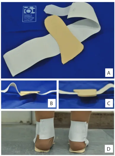 Figure 2. Insoles. (A) Full length ethylene vinyl acetate (EVA) insole  attached to an ankle-sprain support; (B) lateral wedge insole (Group W); 