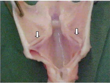 Figure 2 Figure 2 – Specimen (larynx) resected en bloc for subsequent vocal cord (arrows) sampling.