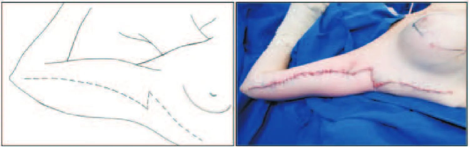 Figure 3 -Figure 3 Figure 3 Figure 3 