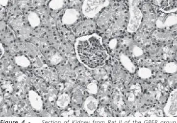 Figure 4 - Section of Kidney from Rat II of the GPER group, where mild tubular congestion and hydropic degeneration are seen, achieving 0.5 grade in the Shih et al
