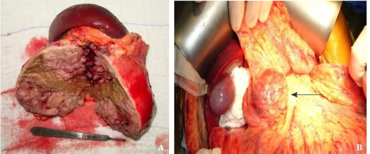 Figure 3 --Figure 3 -Figure 3 Figure 3 