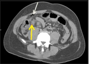 Figure 1 --Figure 1 -Figure 1 