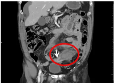 Figure 3 -Figure 3 Figure 3 Figure 3 