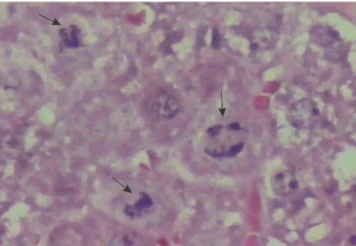 Figure 3 - Photomicrograph of liver section of the Glutamine group stained by HE – presence of mitosis (arrows).
