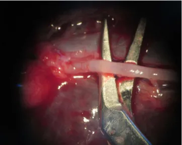 Figure 1 - Splenectomy being performed by UFPR medical students.