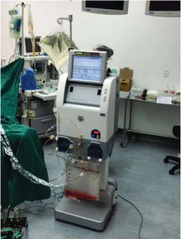 Figure 1.  Performer HT device in use during HIPEC procedure.