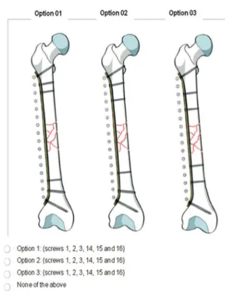 Figure 3.   Example of one of the situations presented to parti- parti-cipants, representing a fracture type AO 32.C3