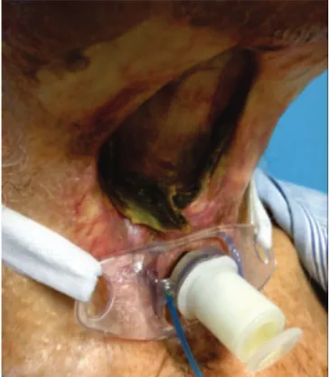 Figure 4.   Laryngeal chondronecrosis, clinical aspect.