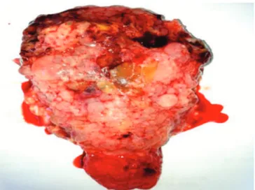 Figure 2. Prophylactic hysterectomy specimen.