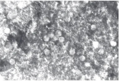 Figure - Presence of Cryptosporidium sp oocysts in feces smears stained with Safranine O methylene blue (100X).