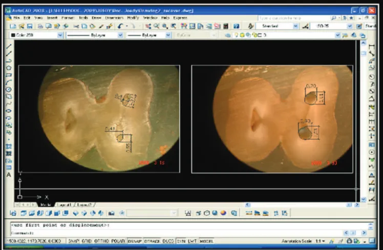 Figure 1. Measuring of the mesial root canals areas using the sotware AutoCAD 2008.