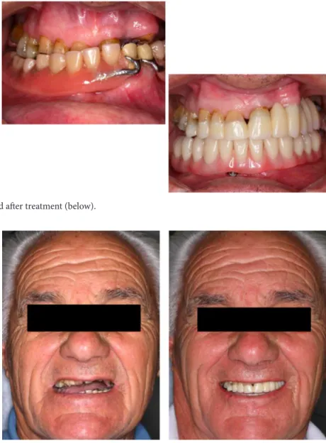 Figure 5. Before (upper) and ater treatment (below).