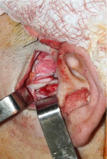 Figure 4. Maximum mouth opening showing proper joint function.