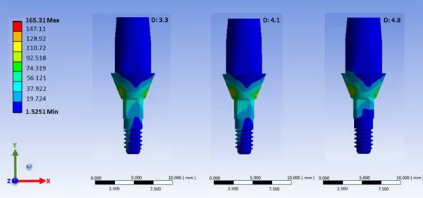 Figure 1. Stress distribution map on prosthetic abutment.