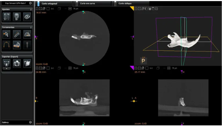 Figure 1. Demonstrative igure of the tomographic images selected or perimeter analysis of increased apical ligament spaces.
