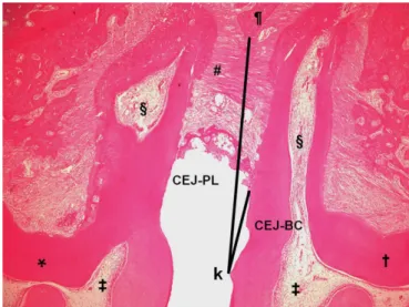 Figure 2. Demonstrates 1st (*) and 2nd (Ɨ) upper molars and: coronal  pulp (‡); radicular pulp (§); cementum enamel junction (k); interproximal  bone crest (¶); conjunctive attachment (#)