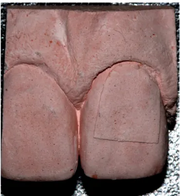 Figure 2. Model in special type IV dental stone cut into block.