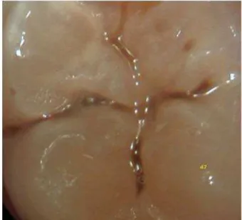 Table 1. Classiication of luorescence images, obtained by Vista Proof, according to the depth of caries lesions