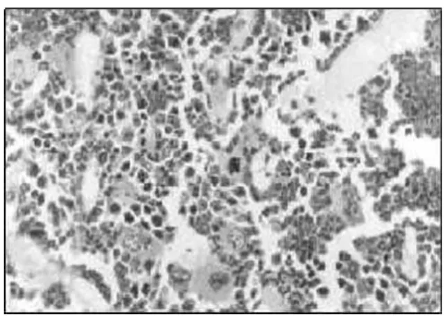 Figure 2. Bone marrow biopsy section from control mice, presenting normal hematopoietic cellularity (over 75%).
