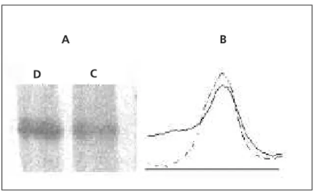 Figure 3. SDS-PAGE profile of ECM proteins obtained from control and undernourished mice