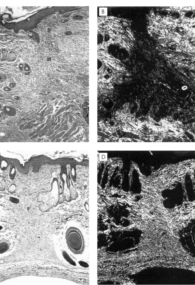 Figure 2.  Photomicrograph of the healing tissue on the 5 th  (A, B) and 21 st  (C, D) postoperative days