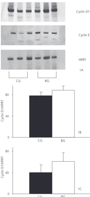 Figure 1. Messenger ribonucleic acid (mRNA) content of cyclin D1 and cyclin E in the colonic mucosa of male Wistar rats 17 weeks after 1.2-dimethylhydrazine (DMH) administration.