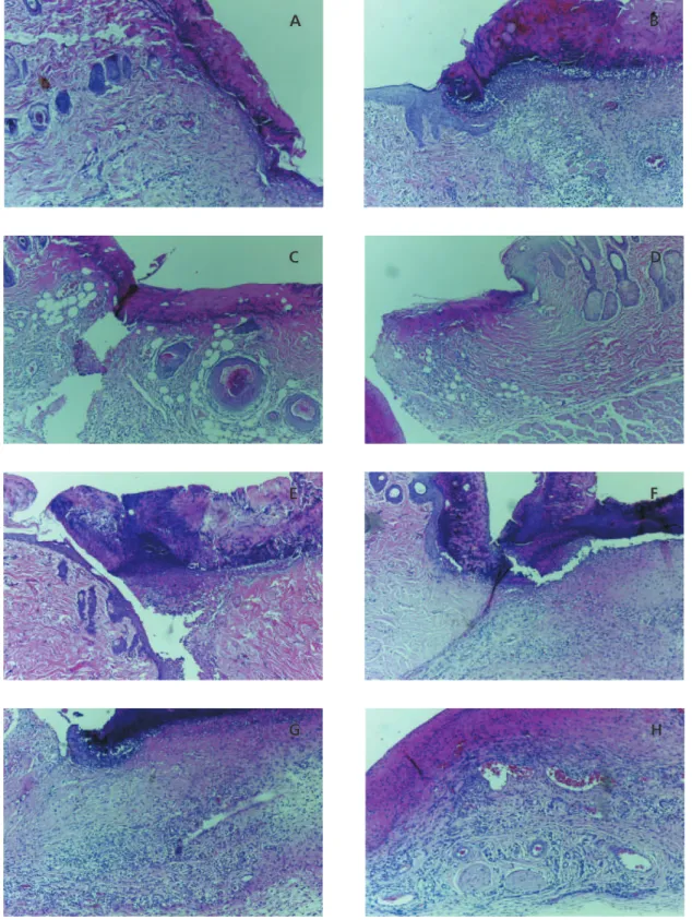 Figure 1. Histological analysis on D3. Right healing by primary intention and left healing by secondary intention