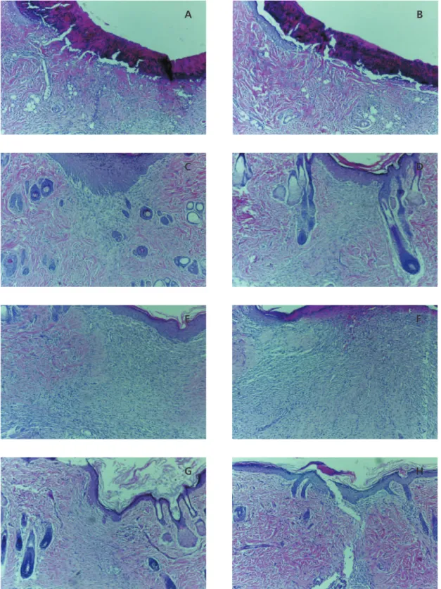 Figure 2. Histological analysis on D7. Right healing by primary intention and left healing by secondary intention