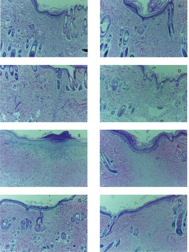 Figure 3. Histological analysis on D14. Right healing by primary intention and left healing by secondary intention