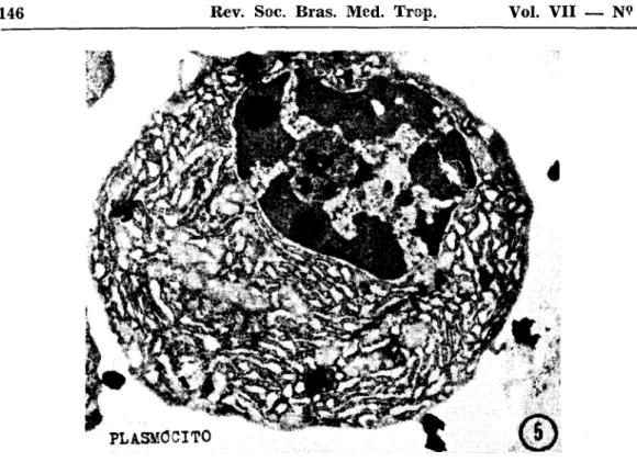 Fig.  11  P lasm ó cito.  F ase  fin a l  de  evolução  dos  lin fó cito s  B.