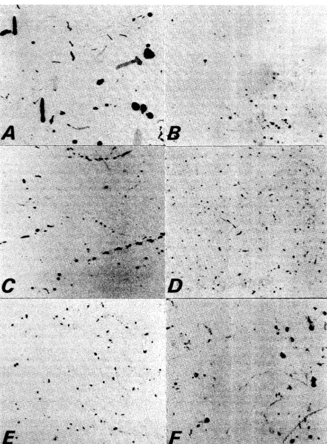 Figure  1 -  L ife  size photographs o f  faecal sm ears a n d  dejecta.  A,   T r i a t o m a   i n f e s t a n s ;   B,   C i m e x   l e u c t u l a r i u s ;   C,