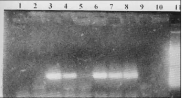 Figure 1 - RT-PCR amplification of EV nucleotide sequences from biopsies samples taken from cardiac patients inhabiting the Amazon region.