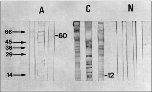 Figure 1 - Western Blot of sera from patients with acute (A) and chronic (C) toxoplasmosis, and normal subjects (N) reacting with Toxoplasma gondii.