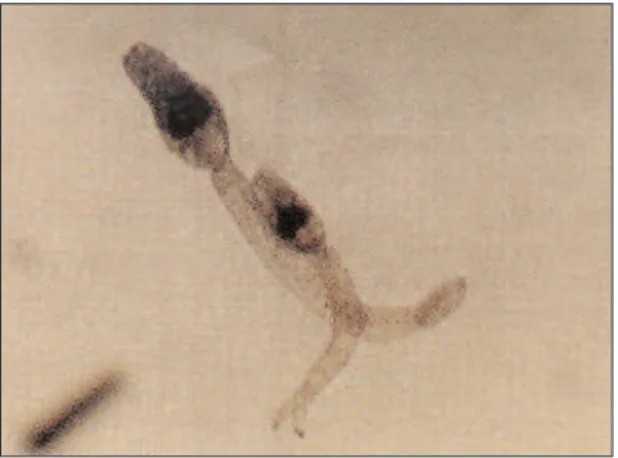 Figura 1 - Microfotografía de las cercarias de la cepa C5 de  Schistosoma mansoni .