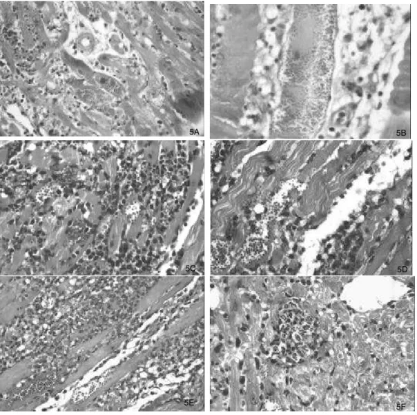 Figure 5A and 5B - Cardiac and skeletal muscle lesions in mice infected with the Colombian parental strain:  A – Diffuse and moderate myocarditis and presence of parasites in the cardiac myocytes (250X);  B – necrosis of skeletal muscle cells with mononucl