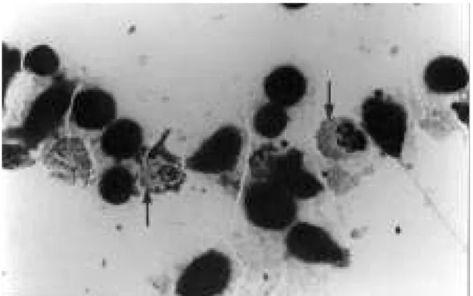 Figure 4 shows a canine mononuclear granulocyte on the fourth day of culture.  Several bodies are evident, displacing the host cell’s nucleus to the periphery