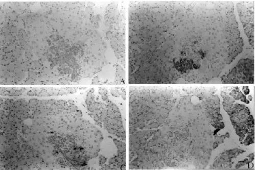 Figure 1 - Parenchyma hypotrophy and lymphocytic infiltrate diffusely distributed, including the islet