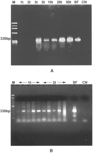 Figure 1 - A ) First Experiment - PCR of samples containing 1 to 50 trypomastigotes (t): M - marker; SF - strain; CN - negative control