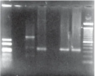 Figure 2 - Polymerase Chain Reaction (PCR) amplification of Trypanosoma cruzi kDNA from the patient esophagus and buffy coat DNA samples using primers S-35/S-36