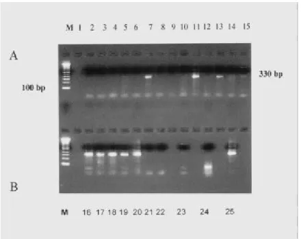 Figure 2 - k DNA Amplification: a: clone CI-Col-C2: samples 1 to 11 and clone CI-Col-C7: samples 12 to 14